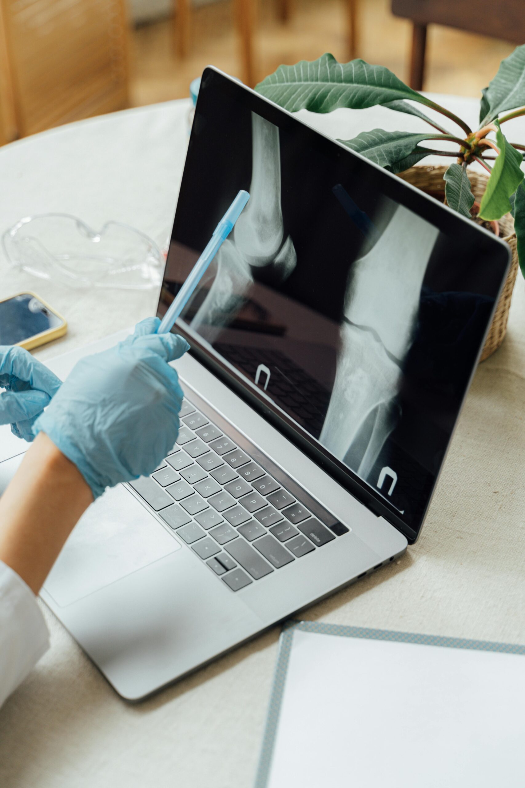Doctor wearing gloves examines bone X-ray on laptop in a clinical setting.